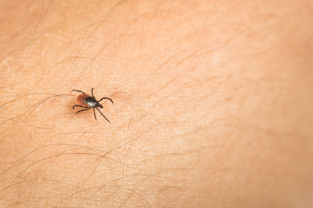 Deer Tick On Skin